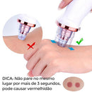Removedor de Cravos e Espinhas PeleLow® - Big Stocks